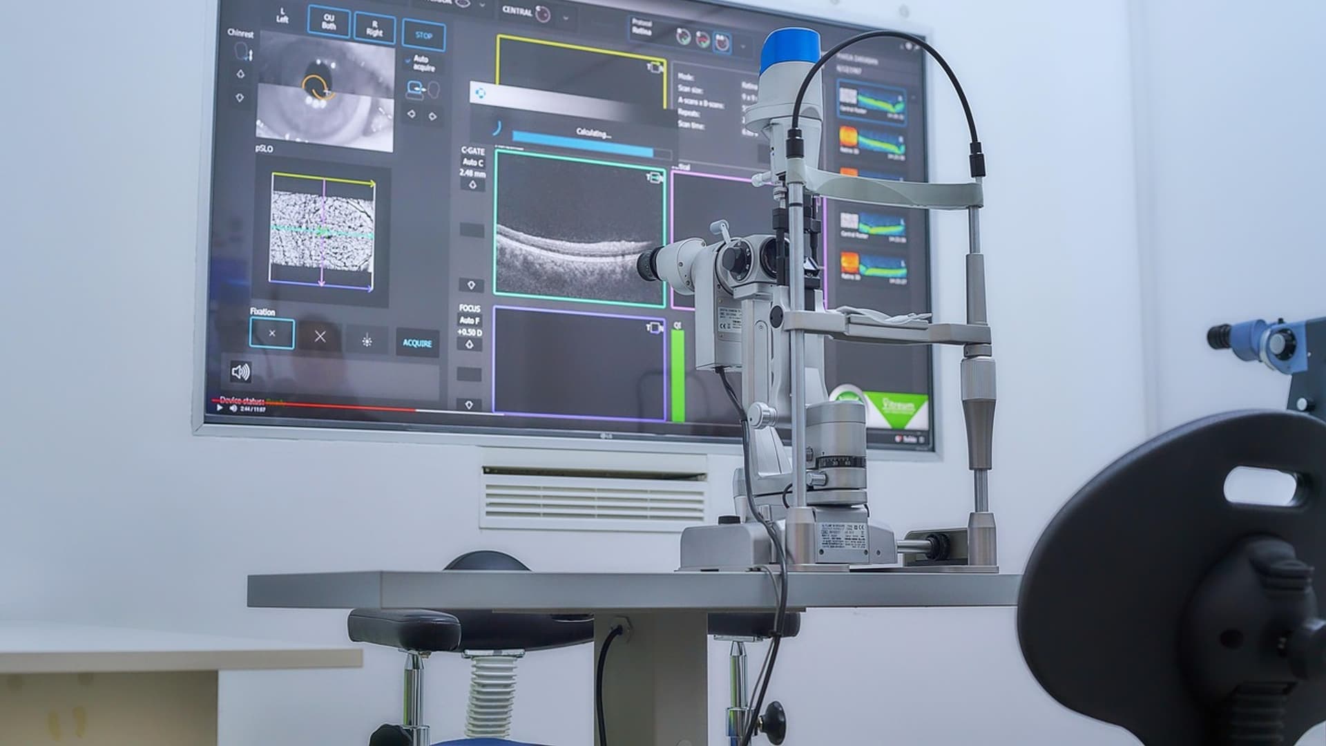 Ophthalmic diagnostic device with a monitor in an eye clinic