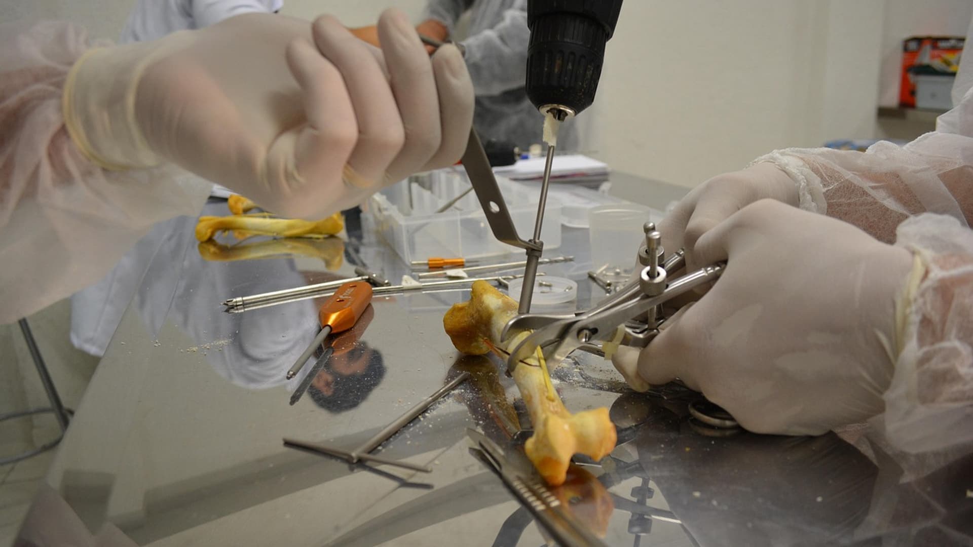 Surgeons’ hands practising on a knee bone model