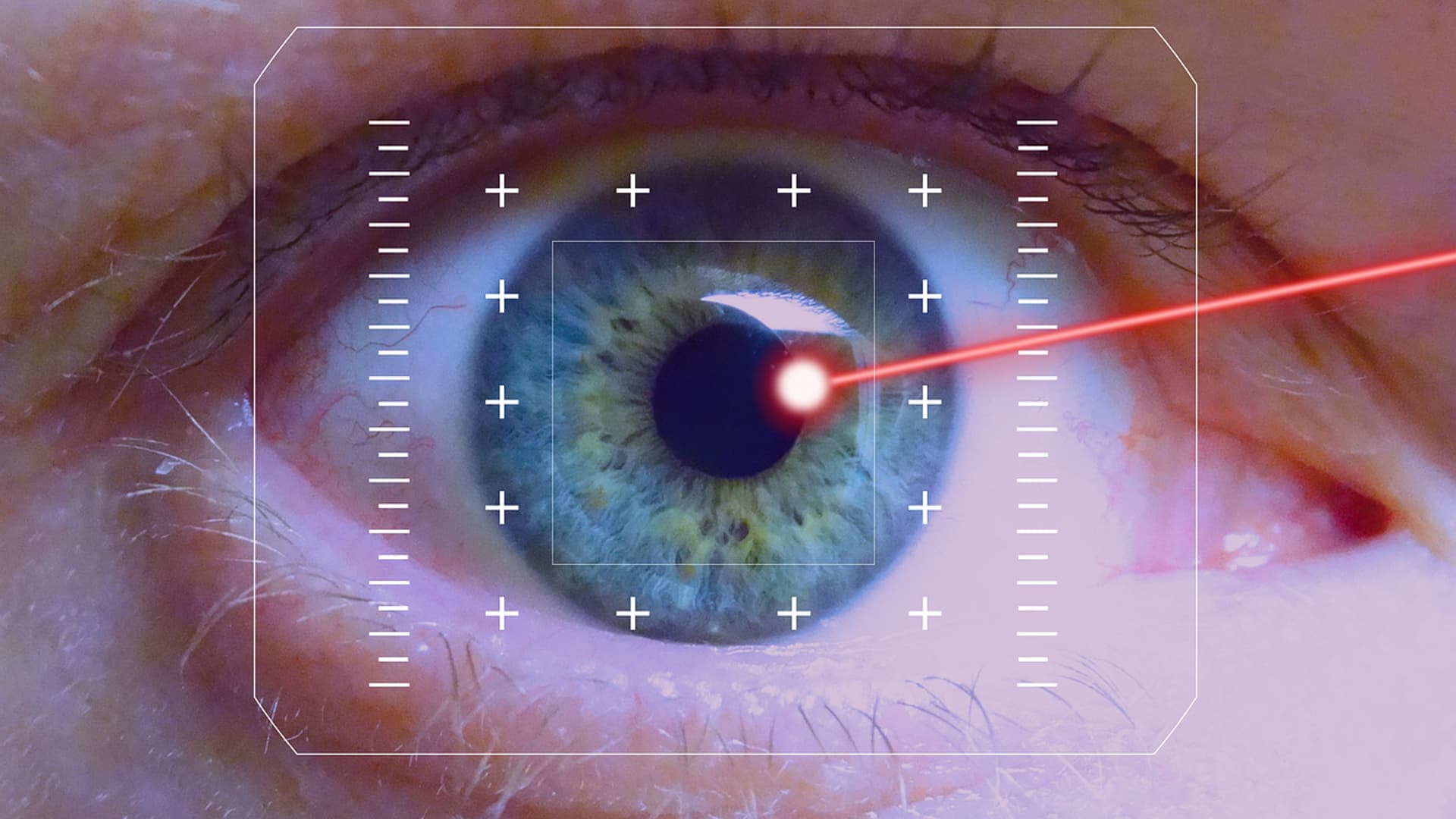 Illustration of a laser beam aimed at an eye